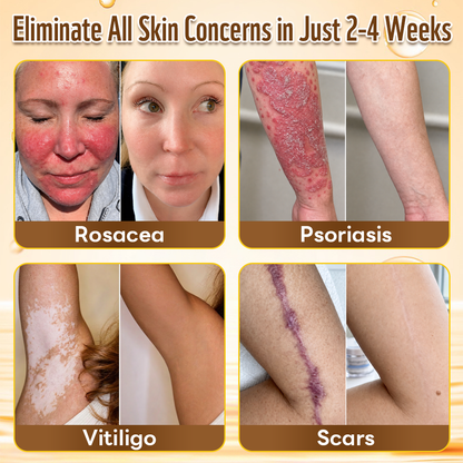 HISKIN® Multi-Concern Skin Repair Cream (One powerful cream to repair inflammation, dryness, aging, pigmentation, and visible skin damage.)