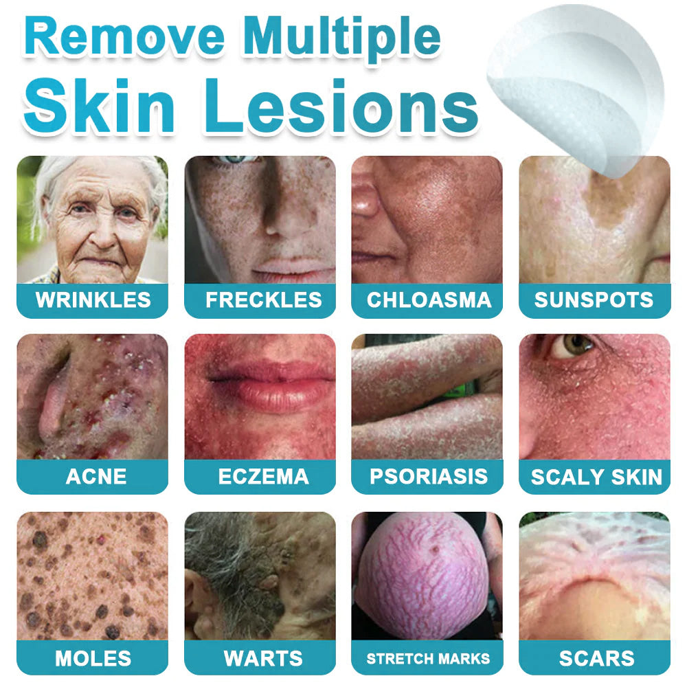 Hiskin ® 2-in-1 Microneedle & Hydrocolloid Patch👨‍⚕️ | Removes raised moles, acne, flat warts, and skin tags | Helps improve wrinkles, scars, and blemishes | Invisible patches for face and body