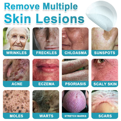 Hiskin ® 2-in-1 Microneedle & Hydrocolloid Patch👨‍⚕️ | Removes raised moles, acne, flat warts, and skin tags | Helps improve wrinkles, scars, and blemishes | Invisible patches for face and body