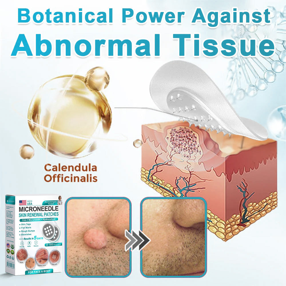 Hiskin ® 2-in-1 Microneedle & Hydrocolloid Patch👨‍⚕️ | Removes raised moles, acne, flat warts, and skin tags | Helps improve wrinkles, scars, and blemishes | Invisible patches for face and body