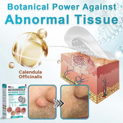 Hiskin ® 2-in-1 Microneedle & Hydrocolloid Patch👨‍⚕️ | Removes raised moles, acne, flat warts, and skin tags | Helps improve wrinkles, scars, and blemishes | Invisible patches for face and body