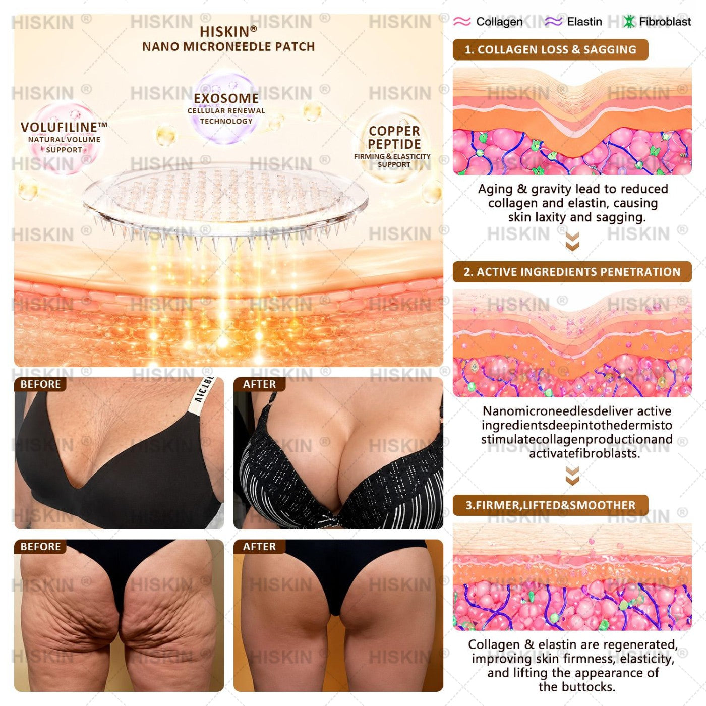 HISKIN® Bust Volume, Lift & Firming Nano Microneedle Patch Volufiline + Exosome + Copper Peptide Formula Powered by Cellular Renewal Technology