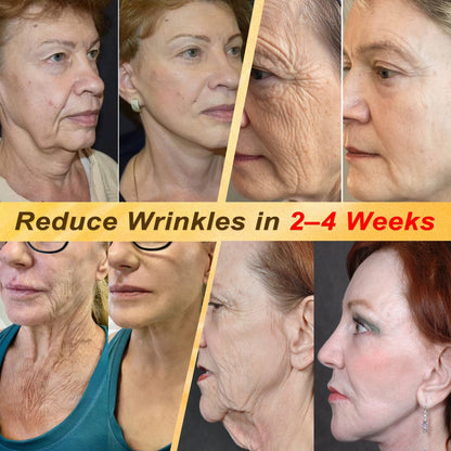 HISKIN® Multi-Concern Skin Repair Cream (One powerful cream to repair inflammation, dryness, aging, pigmentation, and visible skin damage.)