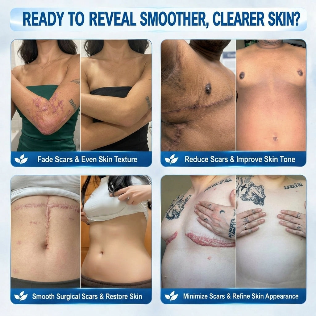 HISKIN®⭐ 𝟕-𝐃𝒂𝘆 Scar & Wart Remover Repair Pen — Advanced Skin Renewal Rollerball Treatment