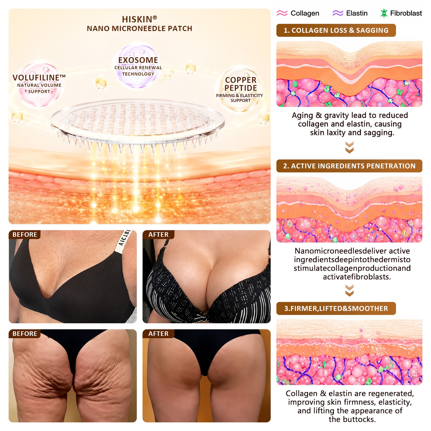 HISKIN® Bust Volume, Lift & Firming Nano Microneedle Patch Volufiline