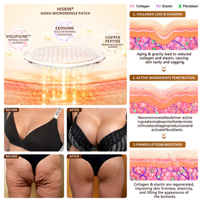 HISKIN® Bust Volume, Lift & Firming Nano Microneedle Patch Volufiline