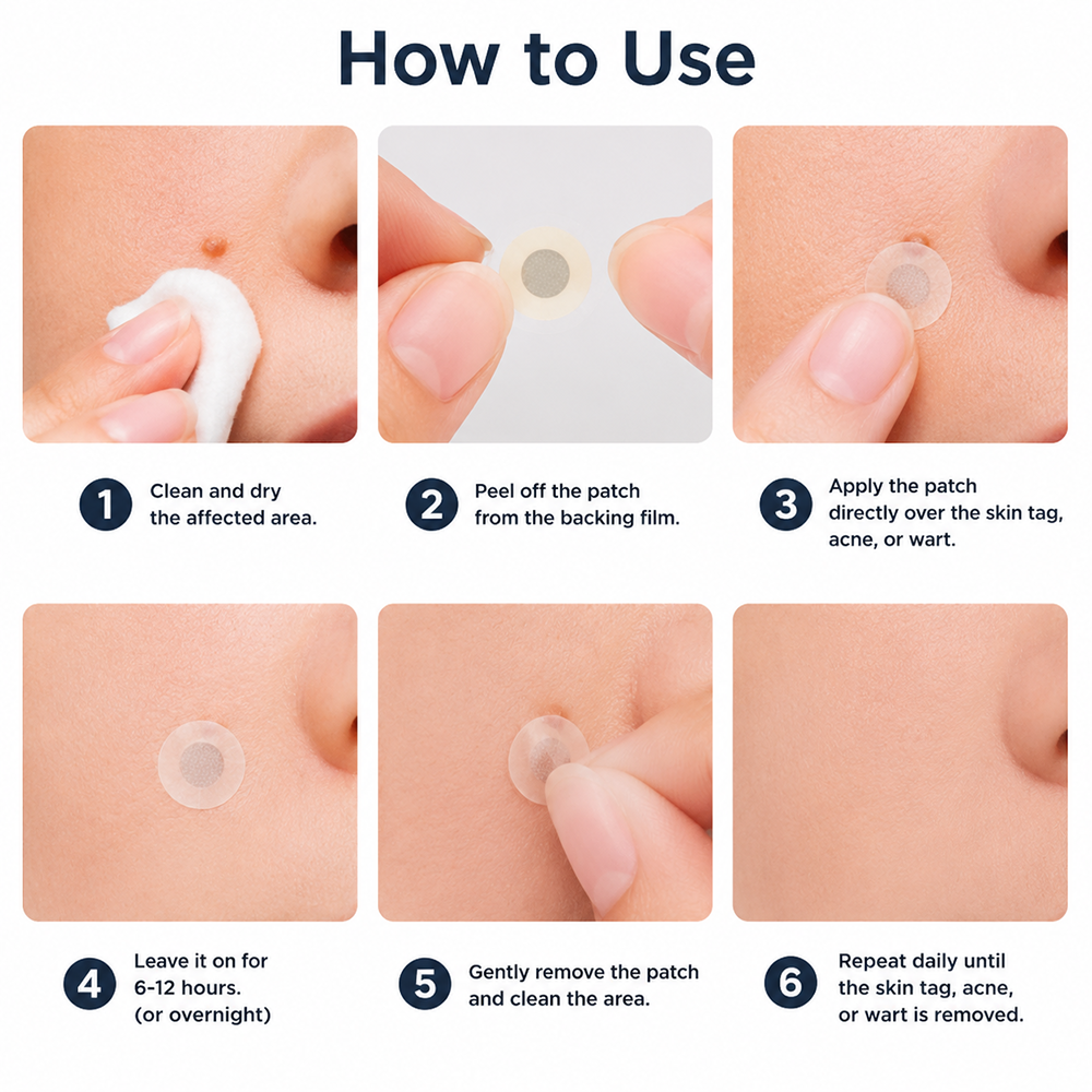 Hiskin ® 2-in-1 Microneedle & Hydrocolloid Patch👨‍⚕️ | Removes raised moles, acne, flat warts, and skin tags | Helps improve wrinkles, scars, and blemishes | Invisible patches for face and body