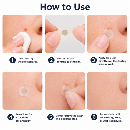 Hiskin ® 2-in-1 Microneedle & Hydrocolloid Patch👨‍⚕️ | Removes raised moles, acne, flat warts, and skin tags | Helps improve wrinkles, scars, and blemishes | Invisible patches for face and body