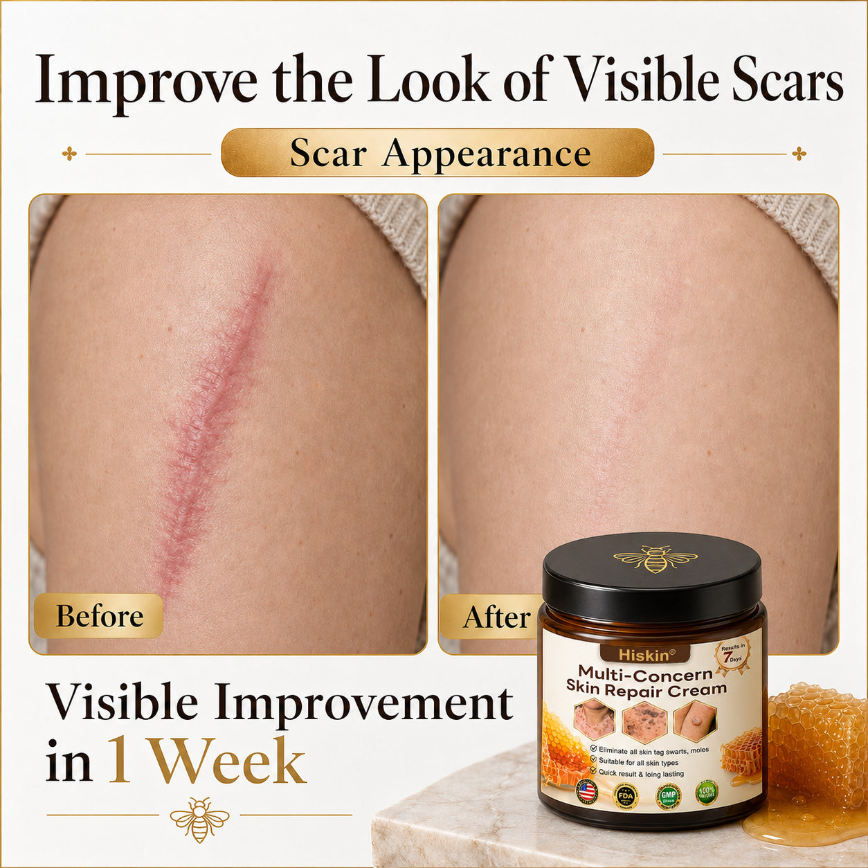 HISKIN® Multi-Concern Skin Repair Cream (One powerful cream to repair inflammation, dryness, aging, pigmentation, and visible skin damage.)