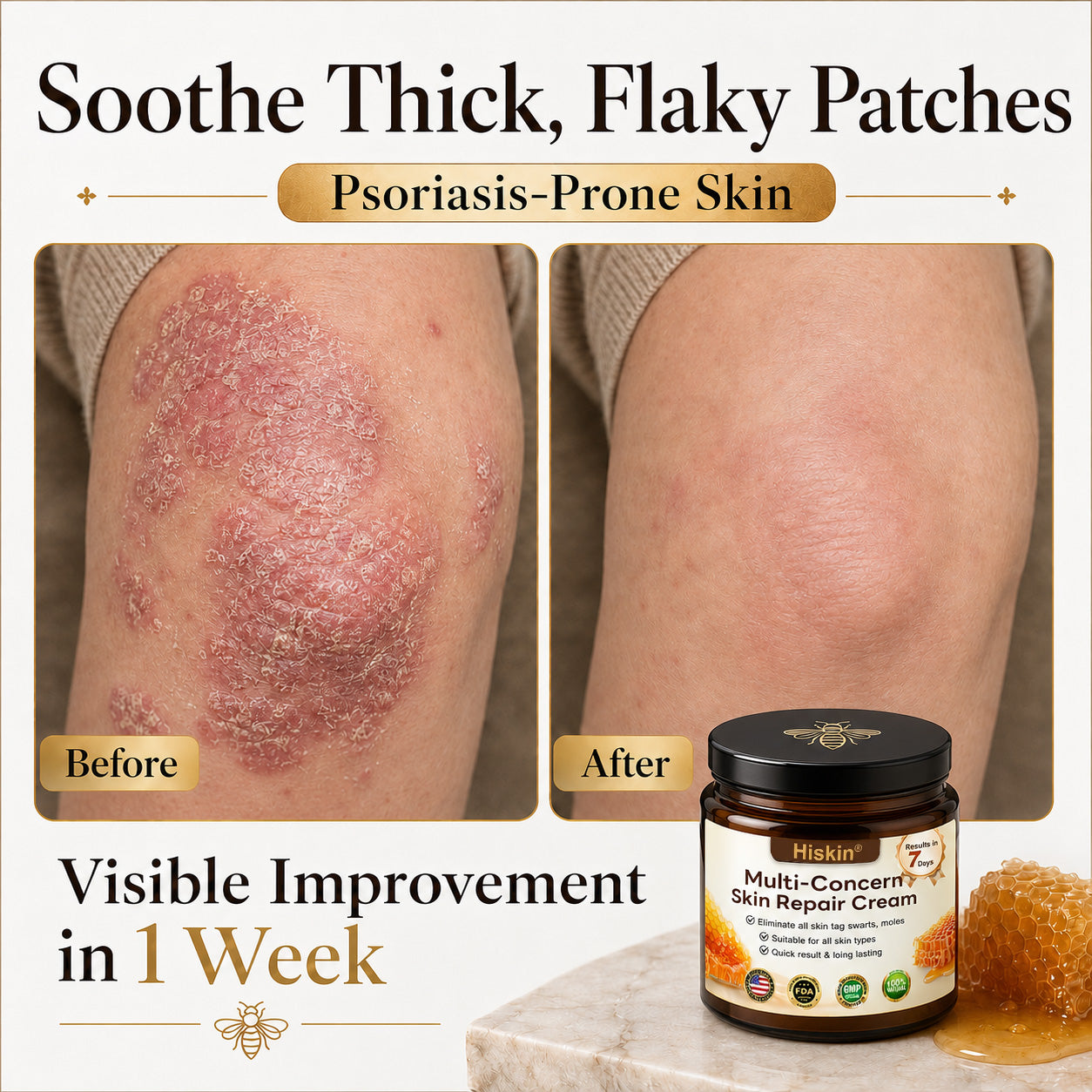 HISKIN® Multi-Concern Skin Repair Cream (One powerful cream to repair inflammation, dryness, aging, pigmentation, and visible skin damage.)